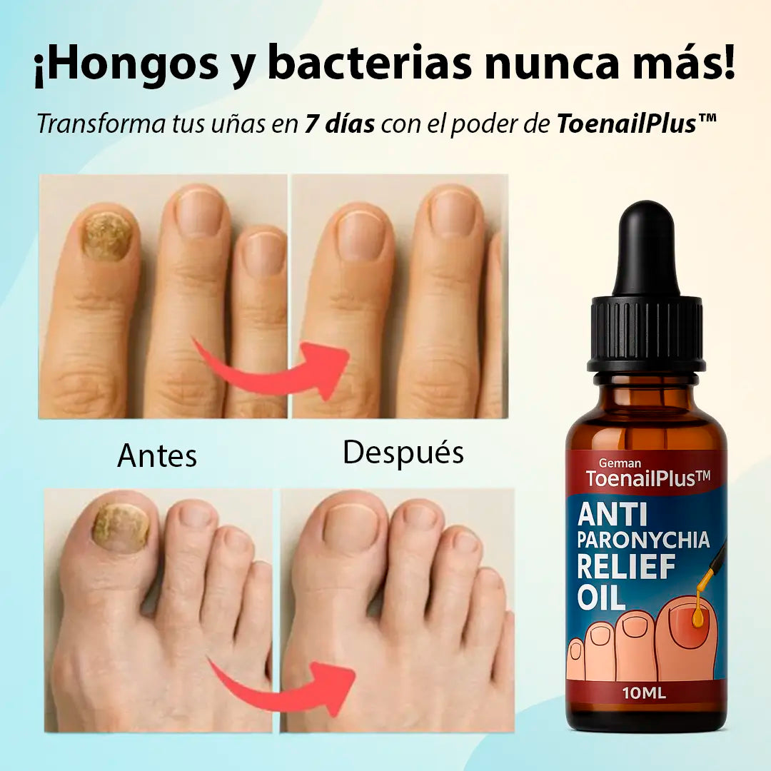 ToenailPlus™ – El fin de los hongos, bacterias y uñas encarnadas