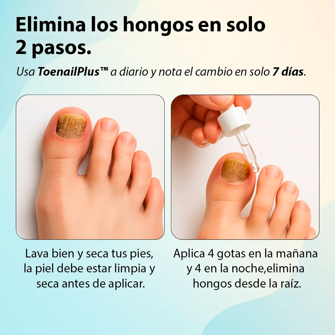 ToenailPlus™ – El fin de los hongos, bacterias y uñas encarnadas
