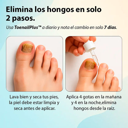 ToenailPlus™ – El fin de los hongos, bacterias y uñas encarnadas