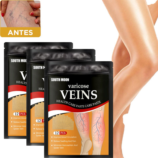 Parches para Venas Varicosas - 🎉 COMPRE 12 Y RECIBA 24 🎉